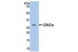 Western Blotting (WB) image for anti-Nuclear Factor of kappa Light Polypeptide Gene Enhancer in B-Cells Inhibitor, epsilon (NFKBIE) (AA 207-440) antibody (ABIN7439441)
