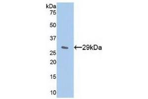 Detection of Recombinant IkBe, Human using Polyclonal Antibody to Inhibitory Subunit Of NF Kappa B Epsilon (IkBe) (Inhibitory Subunit of NF-KappaB epsilon (AA 207-440) antibody)