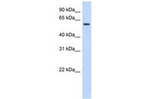 Image no. 1 for anti-Kelch-Like Family Member 42 (KLHL42) (AA 395-444) antibody (ABIN6741106) (KLHDC5 antibody  (AA 395-444))
