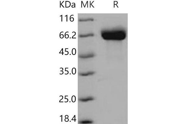 Butyrylcholinesterase Protein (BCHE) (His tag)