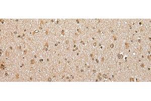 Immunohistochemistry of paraffin-embedded Human brain tissue using ABHD14B Polyclonal Antibody at dilution of 1:30(x200) (ABHD14B antibody)