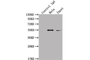 Immunoprecipitating ILK in Hela whole cell lysate Lane 1: Rabbit control IgG instead of ABIN7127572 in Hela whole cell lysate. (Recombinant ILK antibody)