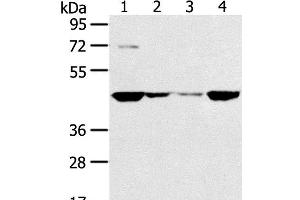 Western Blot analysis of HT-29, 231, hela and A549 cell using SMYD5 Polyclonal Antibody at dilution of 1:200 (SMYD5 antibody)