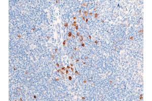 Immunohistochemistry (IHC) image for anti-Checkpoint Kinase 1 (CHEK1) (pSer301) antibody (ABIN6256255)