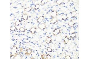 Immunohistochemistry of paraffin-embedded Mouse kidney using SS18L1 Polyclonal Antibody at dilution of 1:100 (40x lens). (SS18L1 antibody)