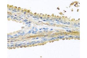 Immunohistochemistry of paraffin-embedded Human prostate using PIP Polyclonal Antibody at dilution of 1:100 (40x lens). (PIP antibody)