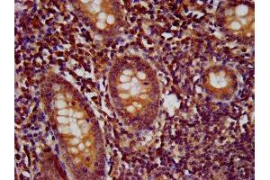 IHC image of ABIN7178015 diluted at 1:500 and staining in paraffin-embedded human appendix tissue performed on a Leica BondTM system. (WDR37 antibody  (AA 1-496))