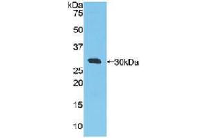 Western blot analysis of recombinant Human RIG1. (DDX58 antibody  (AA 550-776))