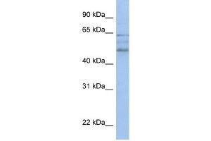 WB Suggested Anti-ZMYND17 Antibody Titration:  0. (ZMYND17 antibody  (C-Term))