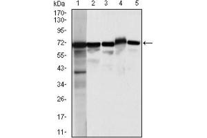 Western Blotting (WB) image for anti-Moesin (MSN) antibody (ABIN1844415) (Moesin antibody)