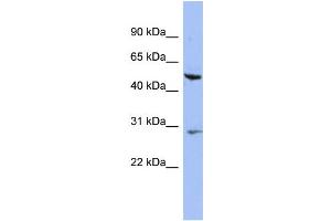 WB Suggested Anti-KRT75 Antibody Titration: 0. (Keratin 75 antibody  (N-Term))