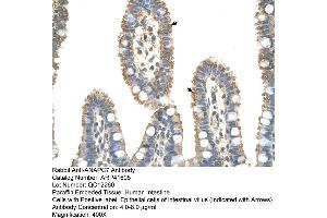 Rabbit Anti-ANAPC7 Antibody  Paraffin Embedded Tissue: Human Intestine Cellular Data: Epithelial cells of intestinal villas Antibody Concentration: 4. (ANAPC7 antibody  (C-Term))