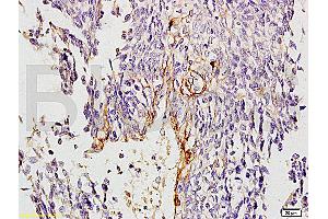 Formalin-fixed and paraffin embedded rat kidney tissue labeled with Anti-Collagen IV Polyclonal Antibody, Unconjugated (ABIN707396) at 1:200, followed by conjugation to the secondary antibody Goat Anti-Rabbit IgG, PE conjugated used at 1:200 dilution for 40 minutes at 37°C. (Collagen IV antibody  (AA 1571-1669))