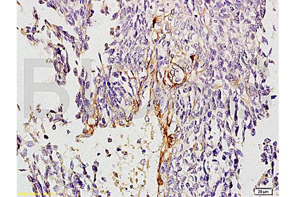 Collagen IV antibody  (AA 1571-1669)