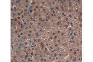Used in DAB staining on fromalin fixed paraffin- embedded liver tissue (Atrophin 1 antibody  (AA 879-1190))