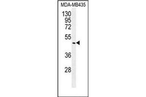 Western blot analysis of BMP14 / GDF5 Antibody (C-term) in MDA-MB435 cell line lysates (35ug/lane).