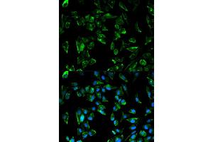 Immunofluorescence analysis of HeLa cells using TPM3 antibody (ABIN5970548). (TPM3 antibody)