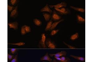 Immunofluorescence analysis of U-2 OS cells using PDE6D Polyclonal Antibody at dilution of 1:100 (40x lens). (PDE6D antibody)