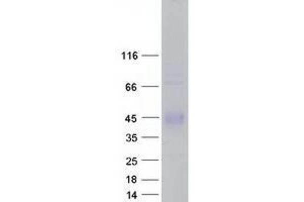 ZPBP2 Protein (Transcript Variant 2) (Myc-DYKDDDDK Tag)