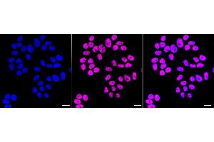 Immunocytochemical staining of HepG2 cells with Histone H2B (formyl K120) antibody (ABIN7798948), 1:1,000). (Recombinant Histone H2B antibody  (H2BK120fo))