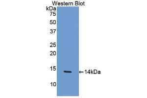 Western blot analysis of the recombinant protein. (CCL4 antibody  (AA 24-92))