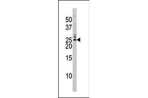 The anti-Phospho-Bad-S75 Pab (ABIN389520 and ABIN2839571) is used in Western blot to detect Phospho-Bad-S75 in HL60 tissue lysate (BAD antibody  (pSer75))