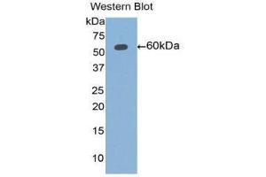 Western Blotting (WB) image for anti-Aldehyde Dehydrogenase 7 Family, Member A1 (ALDH7A1) (AA 1-539) antibody (ABIN1077759) (ALDH7A1 antibody  (AA 1-539))