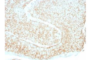 Formalin-fixed, paraffin-embedded human bladder stained with CD59 Mouse Monoclonal Antibody (193-27). (CD59 antibody)