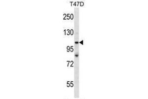 TP53BP2 Antibody (N-term) western blot analysis in T47D cell line lysates (35 µg/lane). (TP53BP2 antibody  (N-Term))