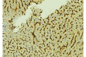 ABIN6276661 at 1/100 staining Mouse liver tissue by IHC-P. (CETP antibody)