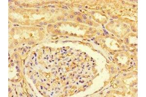 Immunohistochemistry of paraffin-embedded human kidney tissue using ABIN7174143 at dilution of 1:100 (ZRSR2P1 (AA 197-372) antibody)