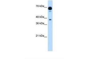 Image no. 1 for anti-Pseudouridylate Synthase 7 Homolog (PUS7) (AA 101-150) antibody (ABIN341308) (PUS7 antibody  (AA 101-150))