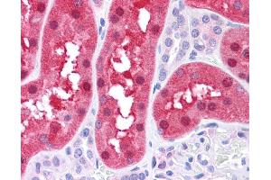 FAH antibody was used for immunohistochemistry at a concentration of 4-8 ug/ml. (FAH antibody)