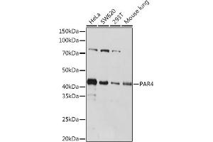 Western blot analysis of extracts of various cell lines, using P Rabbit mAb (ABIN1682842, ABIN3019312, ABIN3019313 and ABIN7101749) at 1:1000 dilution. (PAWR antibody)