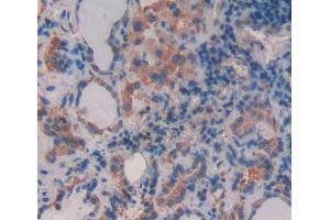 Immunohistochemistry (IHC) image for anti-ATP-Binding Cassette, Sub-Family B (MDR/TAP), Member 9 (ABCB9) (AA 504-766) antibody (ABIN5013191)