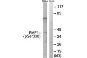 Western blot analysis of extracts from HeLa cells treated with paclitaxel 1uM 24h, using C-RAF (Phospho-Ser338) Antibody. (RAF1 antibody  (pSer338))