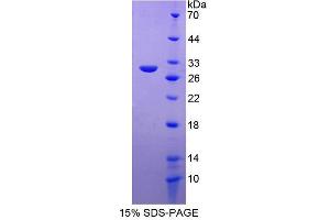 Image no. 1 for Progesterone Immunomodulatory Binding Factor 1 (PIBF1) (AA 13-203) protein (His tag) (ABIN6237654) (PIBF1 Protein (AA 13-203) (His tag))