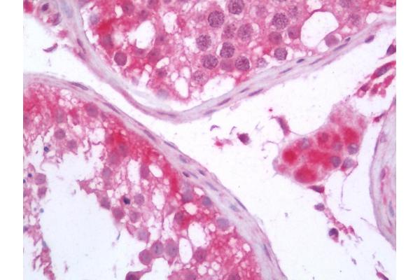 STARD7 antibody  (FITC)