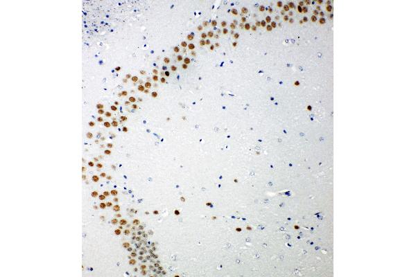 TP53BP1 antibody  (C-Term)