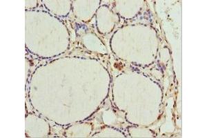 Immunohistochemistry of paraffin-embedded human thyroid tissue using ABIN7172703 at dilution of 1:100 (TAF9 antibody  (AA 1-264))