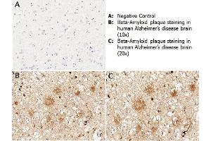 Immunohistochemistry (IHC) image for anti-Amyloid beta (A4) Precursor Protein (APP) antibody (ABIN95037)