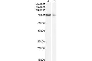 ABIN570800 (1µg/ml) staining of HEK293 (A) and A431 (B) cell lysate (35µg protein in RIPA buffer). (SLCO1B3 antibody  (Internal Region))