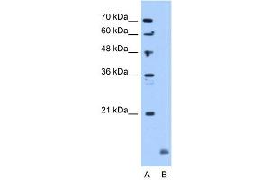 Crystallin Alpha B antibody used at 5 ug/ml to detect target protein. (CRYAB antibody  (C-Term))