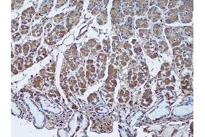 Immunohistochemistry of paraffin-embedded human stomach using SFRP1 antibody (ABIN1682675, ABIN1682676, ABIN5664178 and ABIN6219906) at dilution of 1:50 (20x lens). (SFRP1 antibody  (AA 30-314))