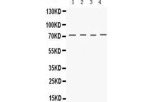 Western Blotting (WB) image for anti-Potassium Voltage-Gated Channel, Shaker-Related Subfamily, Member 4 (KCNA4) (AA 609-647), (C-Term) antibody (ABIN3043264) (Kv1.4 antibody  (C-Term))