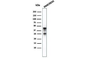 CPA1 antibody