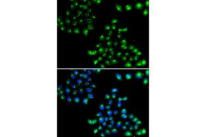 Immunofluorescence analysis of U20S cell using COPB2 antibody.