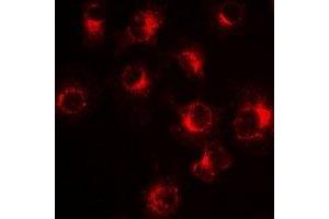 Immunofluorescent analysis of PiT2 staining in Hela cells. (SLC20A2 antibody)