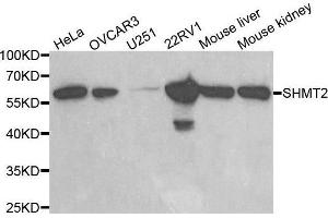 Western blot analysis of extracts of various cell lines, using SHMT2 antibody. (SHMT2 antibody  (AA 265-504))