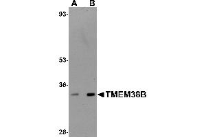Western Blotting (WB) image for anti-Transmembrane Protein 38B (TMEM38B) (C-Term) antibody (ABIN1030755) (TMEM38B antibody  (C-Term))
